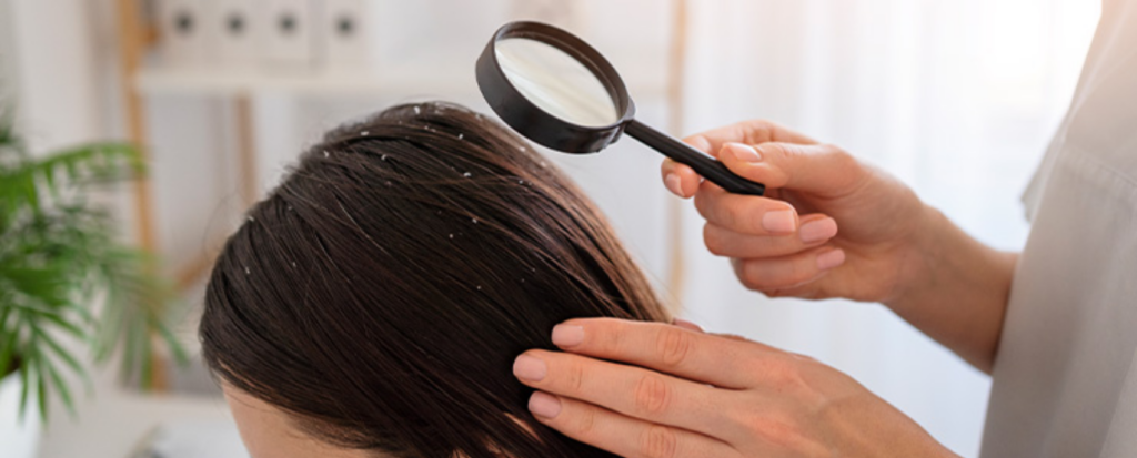 Say Goodbye to Dandruff This December at Ashtamudi Salon!