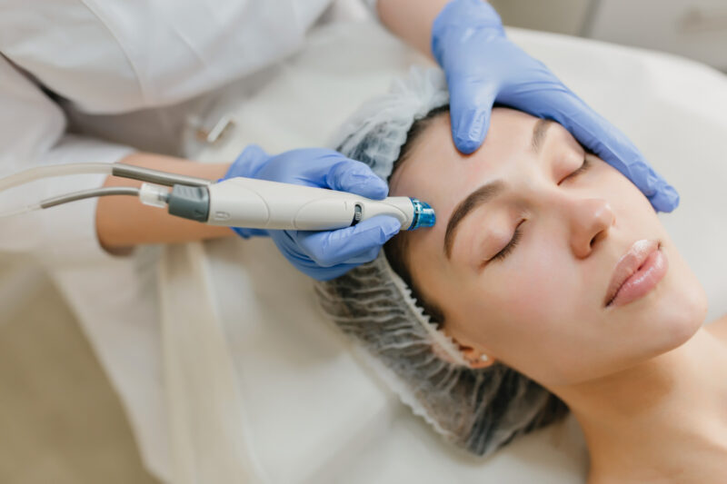 Hydra Facial treatment